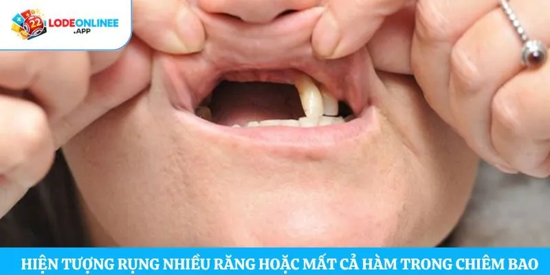 Hiện tượng rụng nhiều răng hoặc mất cả hàm trong chiêm bao